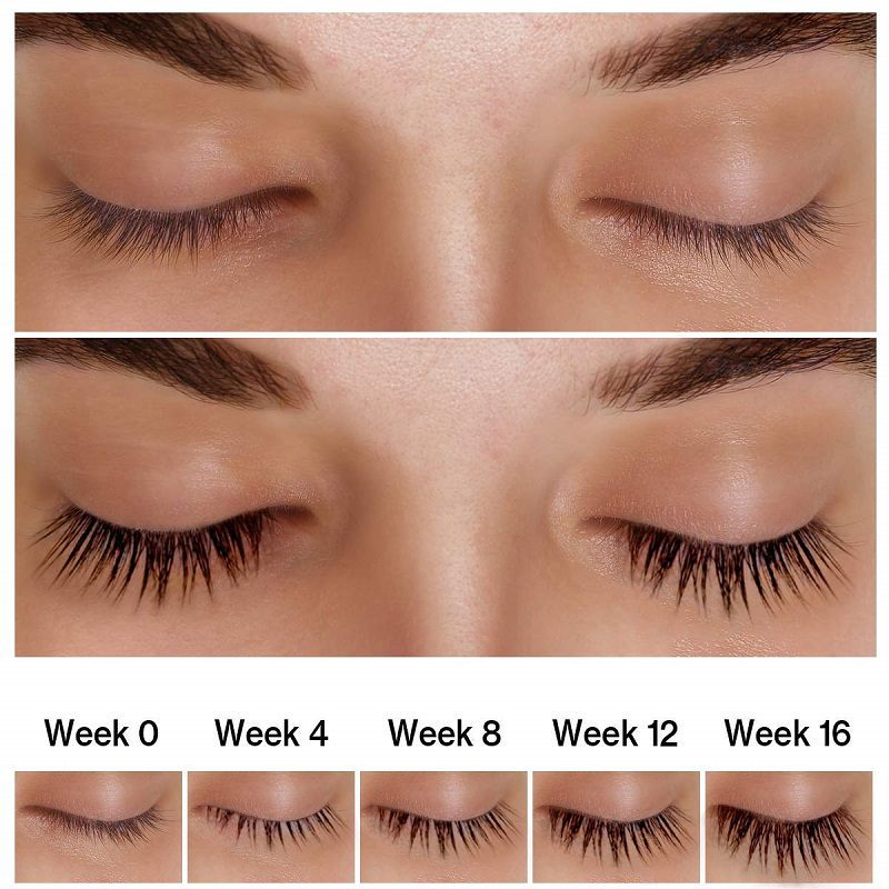 ست سرم تقویت کننده مژه و ابرو اوردینری 5 میل Multi-Peptide Lash ...